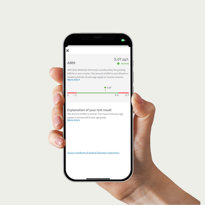 Hand holding a smartphone displaying a medical app with test results on a light gray background